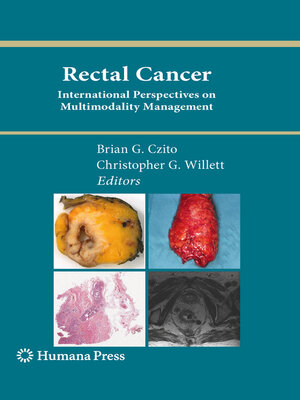 cover image of Rectal Cancer